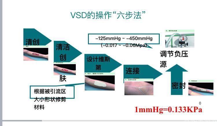 VSD安装教程：一步步教你如何安装和使用VSD